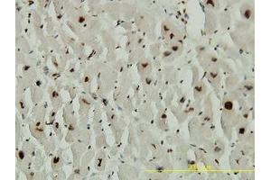 Image no. 1 for anti-Adrenocortical Dysplasia Homolog (ACD) (AA 1-545) antibody (ABIN599297) (ACD antibody  (AA 1-545))