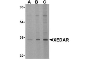 Image no. 1 for anti-Ectodysplasin A2 Receptor (EDA2R) antibody (ABIN318757) (Ectodysplasin A2 Receptor antibody)