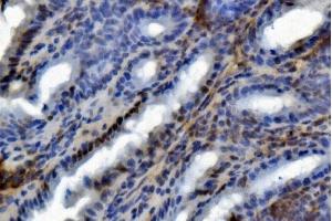 anti-U2 Small Nuclear RNA Auxiliary Factor 2 (U2AF59) (AA 238-470) antibody