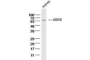 Mouse kidney lysates probed with CD73 Polyclonal Antibody, unconjugated  at 1:300 overnight at 4°C followed by a conjugated secondary antibody for 60 minutes at 37°C.