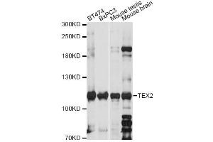 Western blot analysis of extracts of various cell lines, using TEX2 antibody (ABIN6293661) at 1:1000 dilution. (TEX2 antibody)