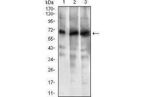Western blot analysis using ABCG5 mouse mAb against HL7702 (1), RAJI (2) and Jurkat (3) cell lysate. (ABCG5 antibody  (AA 306-367))