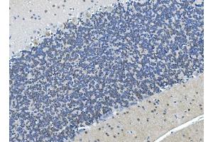 IHC analysis of LSM7 using anti-LSM7 antibody (ABIN7598937). (LSM7 antibody  (AA 1-103))