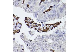 Immunohistochemistry (IHC) image for anti-Complement Factor P (CFP) (AA 190-469) antibody (ABIN6138467)