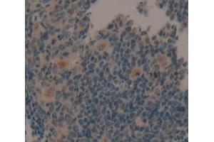 Figure. (SLAMF7 antibody  (AA 23-175))