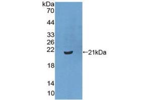 Figure. (XPO1 antibody  (AA 917-1071))