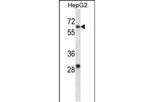 Western Blotting (WB) image for anti-Potassium Voltage-Gated Channel, Shaw-Related Subfamily, Member 1 (KCNC1) (AA 479-508), (C-Term) antibody (ABIN5534634)