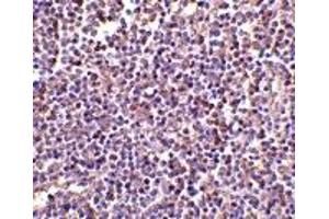 Immunohistochemistry (IHC) image for anti-AIM (N-Term) antibody (ABIN1031223) (AIM (N-Term) antibody)