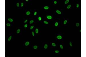 Immunofluorescence staining of Hela Cells with ABIN7127442 at 1:50, counter-stained with DAPI. (Recombinant Cyclin E1 antibody)