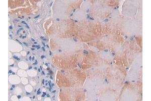 Detection of IL12B in Mouse Skeletal muscle Tissue using Polyclonal Antibody to Interleukin 12B (IL12B) (IL12B antibody  (AA 35-302))