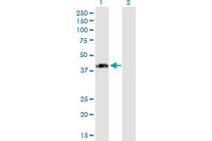 Western Blot analysis of SPG11 expression in transfected 293T cell line by SPG11 MaxPab polyclonal antibody.