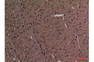 Immunohistochemistry (IHC) analysis of paraffin-embedded Rat Brain, antibody was diluted at 1:100. (SPTLC1 antibody  (C-Term))