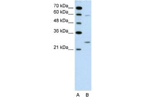 WB Suggested Anti-GAMT Antibody Titration:  0. (GAMT antibody  (N-Term))