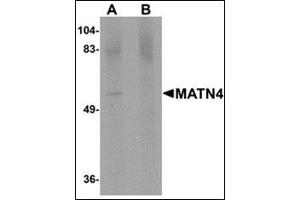 Western blot analysis of MATN4 in rat brain tissue lysate with this product at 1 μg/ml in (A) the absence and (B) the presence of blocking peptide.