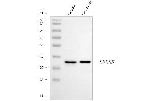 Western blot analysis of SFXN5 using anti-SFXN5 antibody (ABIN7601388). (Sideroflexin 5 antibody  (AA 34-340))