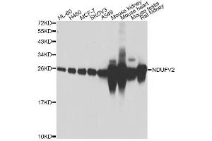 Western blot analysis of extracts of various cell lines, using NDUFV2 antibody (ABIN4904507) at 1:1000 dilution. (NDUFV2 antibody)