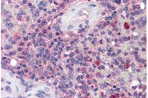 Human Spleen (formalin-fixed, paraffin-embedded) stained with KPNB1 antibody ABIN337256 at 5 ug/ml followed by biotinylated anti-goat IgG secondary antibody ABIN481715, alkaline phosphatase-streptavidin and chromogen. (KPNB1 antibody  (AA 851-863))