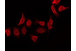ABIN6269150 staining 293 by IF/ICC. (Ezrin antibody  (C-Term))
