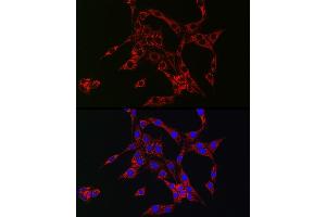 Immunofluorescence analysis of PC-12 cells using HB-EGF Rabbit pAb (ABIN6130449, ABIN6141644, ABIN6141645 and ABIN6218793) at dilution of 1:150 (40x lens). (HBEGF antibody  (AA 20-160))