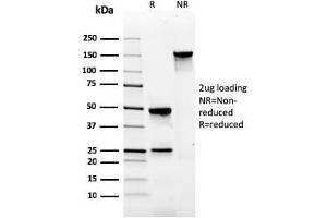 SDS-PAGE Analysis Purified Gastrin Mouse Monoclonal Antibody (GAST/2634).