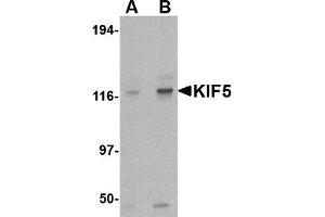 Western Blotting (WB) image for anti-Kinesin Family Member 5A (KIF5A) (Middle Region) antibody (ABIN1030974) (KIF5A antibody  (Middle Region))