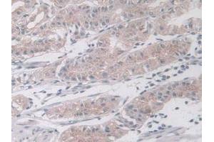 IHC-P analysis of Human Liver Tissue, with DAB staining. (MAPK12 antibody  (AA 27-311))