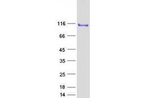 Validation with Western Blot (SND1 Protein (Myc-DYKDDDDK Tag))