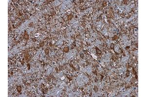 IHC-P Image C3 antibody [C3], C-term detects C3 protein at cytoplasm in mouse brain by immunohistochemical analysis. (C3 antibody  (C-Term))