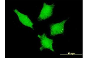 Immunofluorescence of monoclonal antibody to DDX20 on HeLa cell. (DDX20 antibody  (AA 725-824))