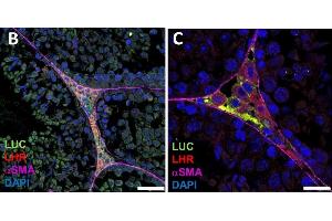 Immunofluorescence (Paraffin-embedded Sections) (IF (p)) image for anti-Luteinizing Hormone/Choriogonadotropin Receptor (LHCGR) (C-Term) antibody (ABIN2857013)