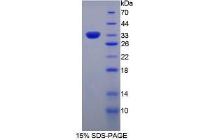 SDS-PAGE analysis of Human Spondin 1 Protein.