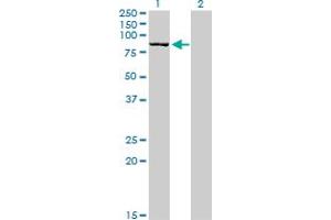 Western Blot analysis of DLG3 expression in transfected 293T cell line by DLG3 monoclonal antibody (M03), clone 2B6. (DLG3 antibody  (AA 281-380))
