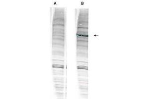 Western blot analysis is shown using  anti-Human WHIP antibody with and without pre-incubation with blocking peptide. (WRNIP1 antibody  (Internal Region, Isoform 1, Isoform 2))