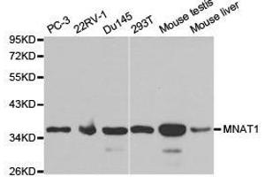 Western Blotting (WB) image for anti-Menage A Trois Homolog 1, Cyclin H Assembly Factor (Xenopus Laevis) (MNAT1) antibody (ABIN1873734)