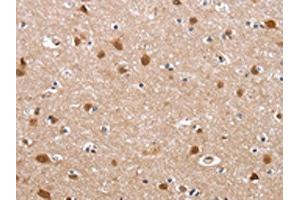 The image on the left is immunohistochemistry of paraffin-embedded Human brain tissue using ABIN7129189(DEFA6 Antibody) at dilution 1/40, on the right is treated with fusion protein. (DEFA6 antibody)