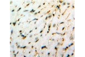Immunohistochemistry (IHC) image for anti-Heat Shock 22kDa Protein 8 (HSPB8) (AA 1-196) antibody (ABIN1078126)