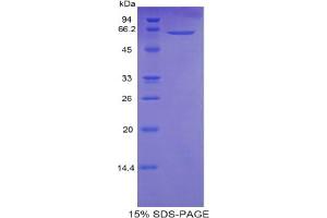 SDS-PAGE analysis of Human Calmodulin 1 Protein.