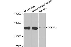 Western blot analysis of extracts of various cell lines, using COL1A2 antibody. (COL1A2 antibody)
