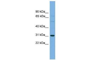 Western Blot showing SLCO1B1 antibody used at a concentration of 1-2 ug/ml to detect its target protein. (SLCO1B1 antibody  (Middle Region))