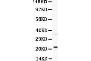 Anti-Bid antibody, Western blotting All lanes: Anti Bid at 0. (BID antibody  (C-Term))