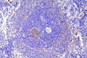 IHC analysis of SCN11A using anti-SCN11A antibody (ABIN7603132).