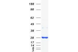 Validation with Western Blot (YWHAB Protein (Transcript Variant 2) (Myc-DYKDDDDK Tag))