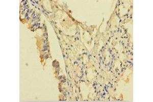 Immunohistochemistry of paraffin-embedded human lung tissue using ABIN7168126 at dilution of 1:100 (RPP29 antibody  (AA 1-220))