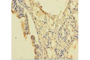Immunohistochemistry of paraffin-embedded human lung tissue using ABIN7168126 at dilution of 1:100 (RPP29 antibody  (AA 1-220))