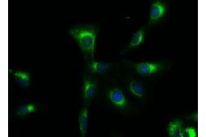 Immunofluorescent staining of A549 cells using anti-SOX17 mouse monoclonal antibody (ABIN2452377). (SOX17 antibody  (AA 177-414))