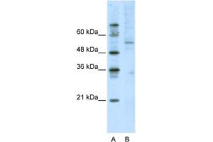 WB Suggested Anti-ATF7 Antibody Titration:  2. (AFT7 antibody  (C-Term))