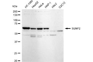 Western blotting analysis using SENP2 antibody (ABIN7800976).