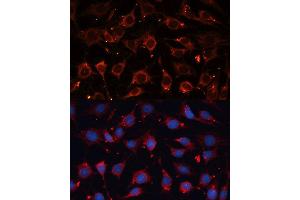Immunofluorescence analysis of C6 cells using CASP3 antibody. (Caspase 3 antibody  (AA 55-160))
