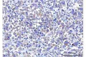 IHC analysis of RPS5 using anti-RPS5 antibody (ABIN7599076). (RPS5 antibody  (AA 1-204))
