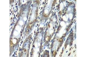Immunohistochemistry of paraffin-embedded Rat Intestine using SEPT7 Polyclonal Antibody at dilution of 1:100 (40x lens). (Septin 7 antibody)